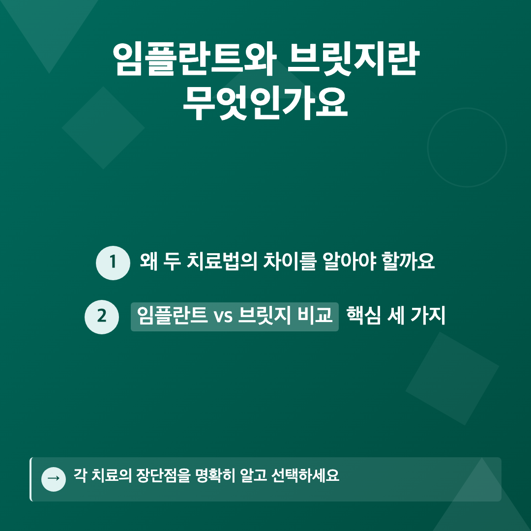임플란트와 브릿지란 무엇인가요 - 임플란트 vs 브릿지 비교