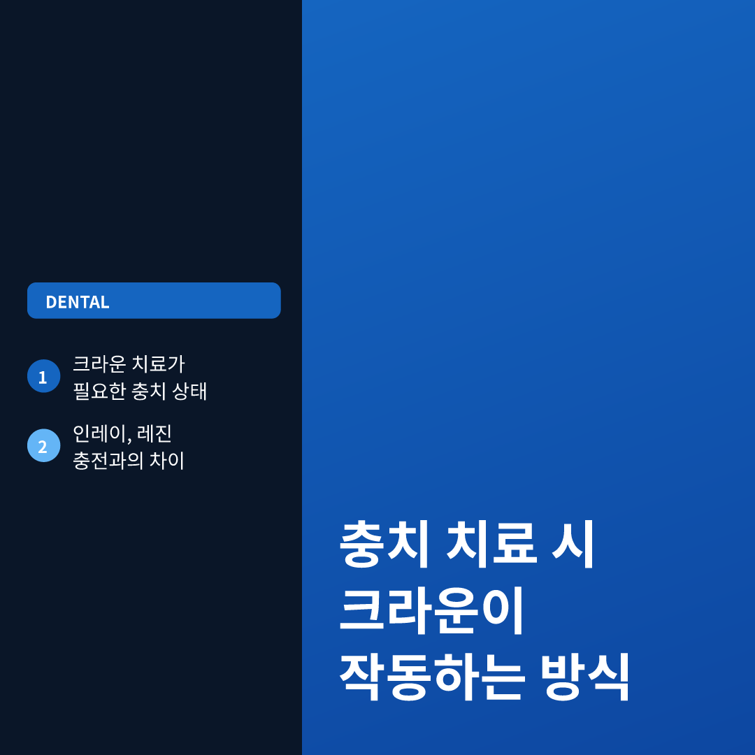충치 크라운 언제 해야하나 이미지 2